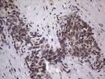 GLI2 Antibody in Immunohistochemistry (Paraffin) (IHC (P))