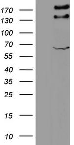 GLI2 Antibody in Western Blot (WB)