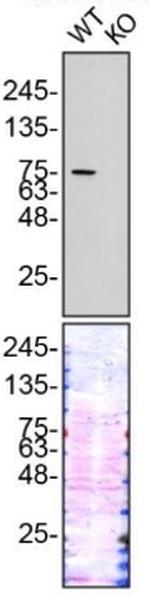 Gelsolin Antibody