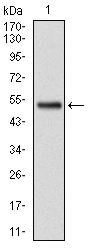 GSTM1 Antibody in Western Blot (WB)