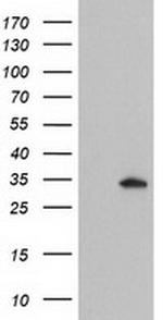 GSTO2 Antibody in Western Blot (WB)