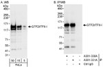 GTF2I/TFII-I Antibody in Western Blot (WB)