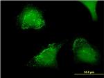 ACP5 Antibody in Immunocytochemistry (ICC/IF)