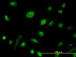 AK1 Antibody in Immunocytochemistry (ICC/IF)