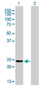 AK1 Antibody in Western Blot (WB)