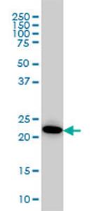 AK1 Antibody in Western Blot (WB)