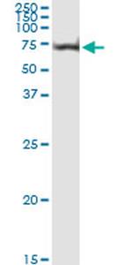 AKT1 Antibody in Immunoprecipitation (IP)