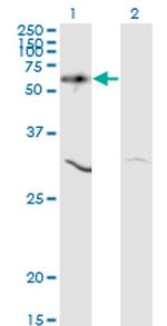 AKT1 Antibody in Western Blot (WB)