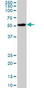 AKT1 Antibody in Western Blot (WB)