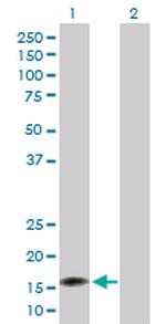 NUDT2 Antibody in Western Blot (WB)