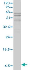 APOC1 Antibody in Western Blot (WB)