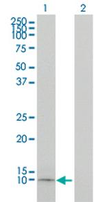 APOC1 Antibody in Western Blot (WB)