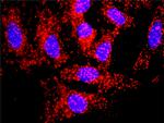 APP Antibody in Proximity Ligation Assay (PLA) (PLA)