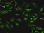 ARAF Antibody in Immunocytochemistry (ICC/IF)