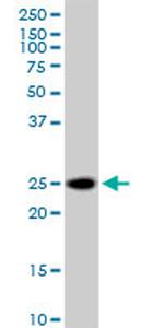 ARHGDIA Antibody in Western Blot (WB)