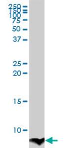 ATOX1 Antibody in Western Blot (WB)