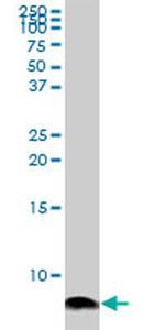 ATOX1 Antibody in Western Blot (WB)