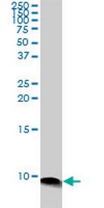 ATOX1 Antibody in Western Blot (WB)