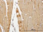 ATP2A1 Antibody in Immunohistochemistry (Paraffin) (IHC (P))