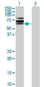 ATP6V1B2 Antibody in Western Blot (WB)