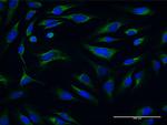 ATP5O Antibody in Immunocytochemistry (ICC/IF)