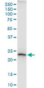 ATP5O Antibody in Western Blot (WB)