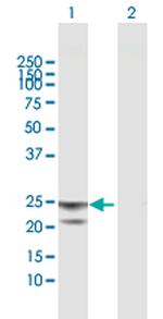 ATP5O Antibody in Western Blot (WB)