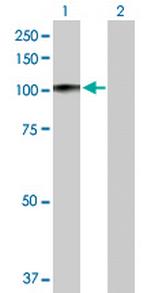 PRDM1 Antibody in Western Blot (WB)
