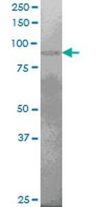 PRDM1 Antibody in Western Blot (WB)