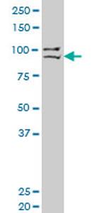 PRDM1 Antibody in Western Blot (WB)