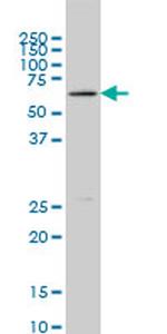 BLK Antibody in Western Blot (WB)