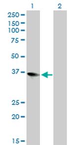 ZFP36L1 Antibody in Western Blot (WB)