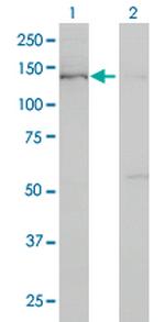 BUB1 Antibody in Western Blot (WB)