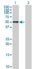 CALR Antibody in Western Blot (WB)