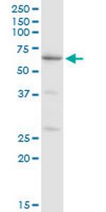 CAT Antibody in Western Blot (WB)