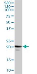 CAV1 Antibody in Western Blot (WB)