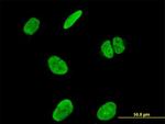 RUNX2 Antibody in Immunocytochemistry (ICC/IF)