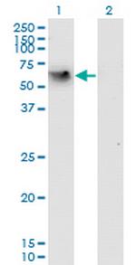 CD44 Antibody in Western Blot (WB)