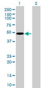 RCC1 Antibody in Western Blot (WB)