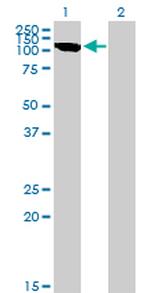 CLCN2 Antibody in Western Blot (WB)