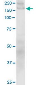 COL1A1 Antibody in Western Blot (WB)