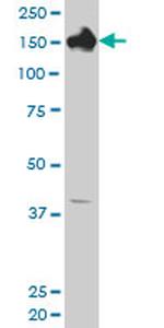 CPS1 Antibody in Western Blot (WB)