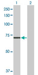 CPT2 Antibody in Western Blot (WB)