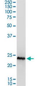 CSH1 Antibody in Western Blot (WB)