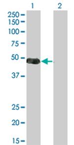 NKX2-5 Antibody in Western Blot (WB)