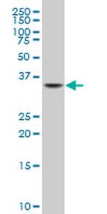 NKX2-5 Antibody in Western Blot (WB)