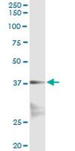 NKX2-5 Antibody in Immunoprecipitation (IP)