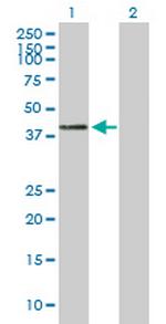 CTSH Antibody in Western Blot (WB)