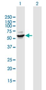 CYP3A4 Antibody in Western Blot (WB)