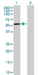 DARS Antibody in Western Blot (WB)